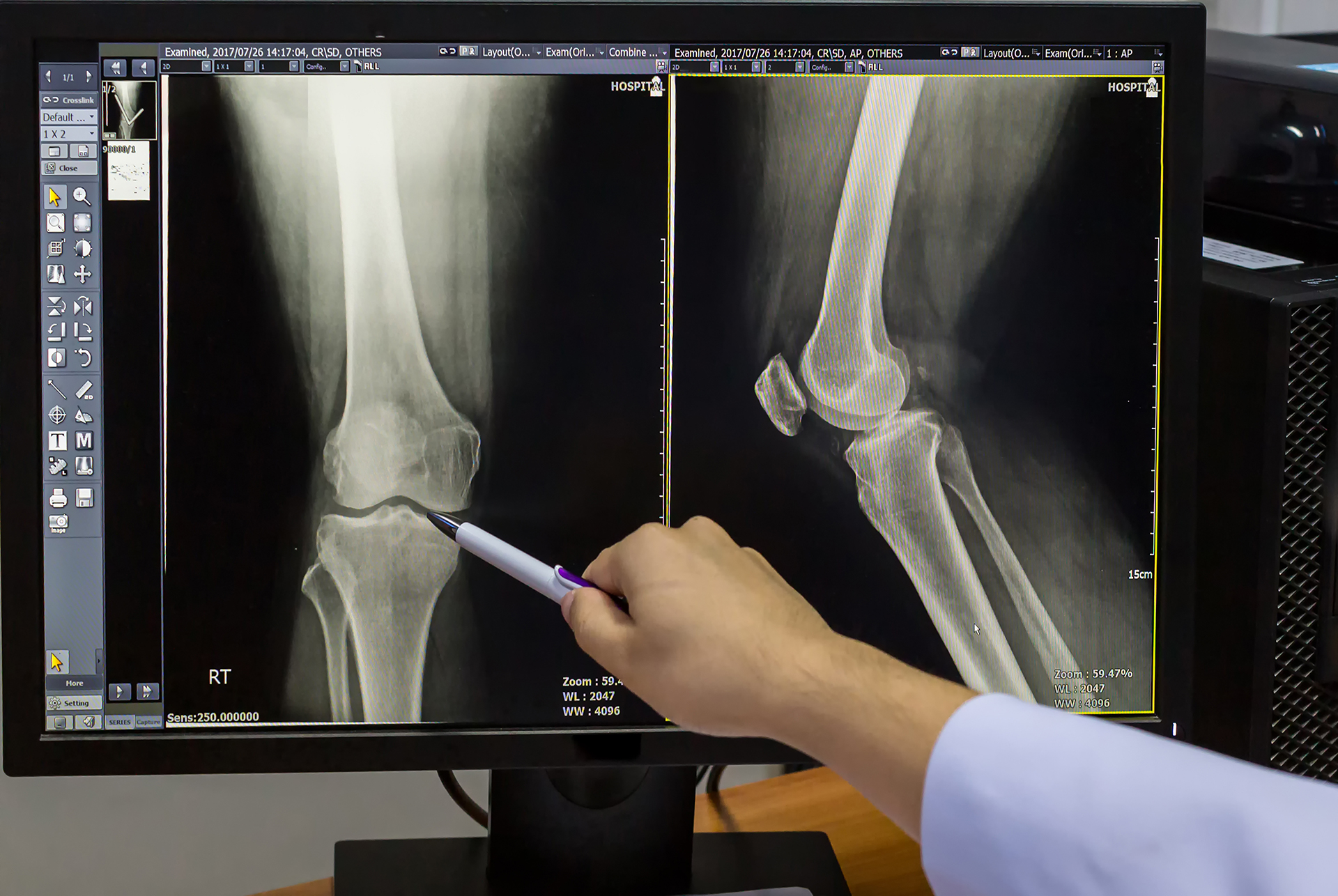 xray.jpeg