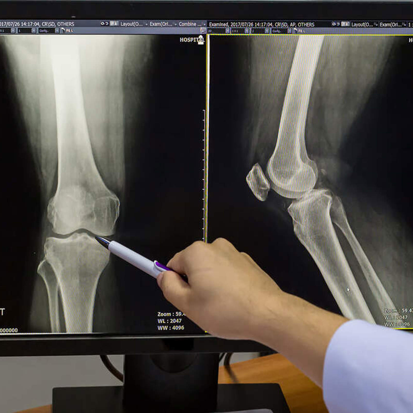xray.jpeg